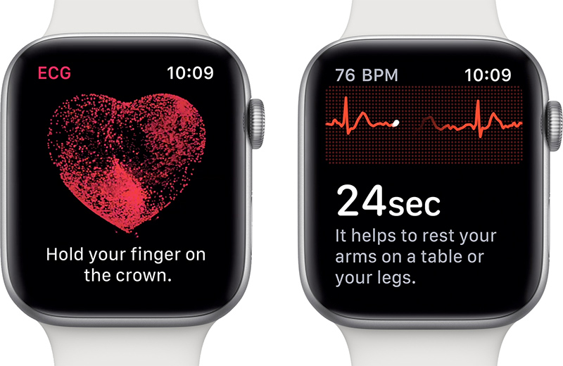ECG Feature on Apple Watch Could Take Years to Be Approved ...
