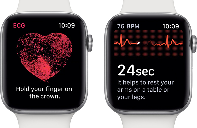 does apple watch 5 have ekg