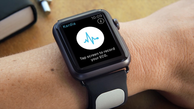 ekg on apple watch