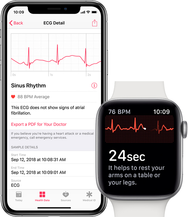 does apple watch 5 have ekg